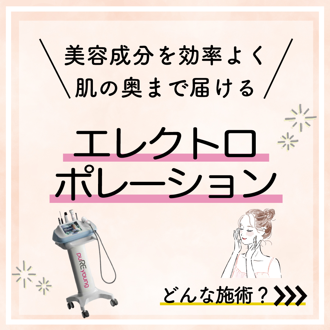 大人気の肌育施術【エレクトロポレーション】って？薬剤一覧表も！