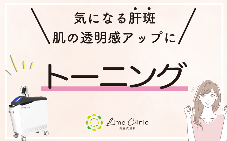 肝斑・くすみをダウンタイムほぼゼロで改善！レーザートーニング治療とは