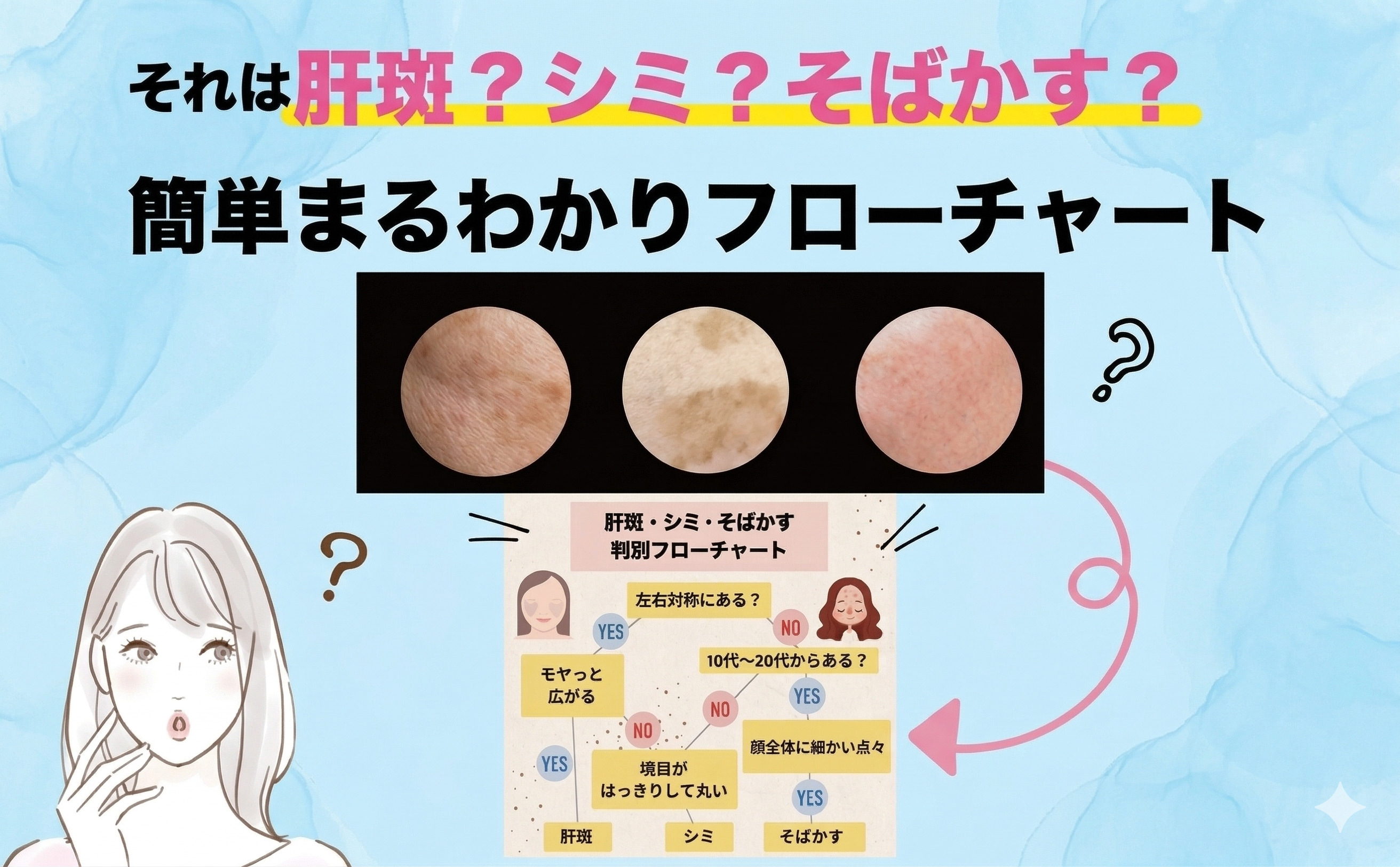 「それは肝斑？シミ？そばかす？」簡単フローチャートでチェック！