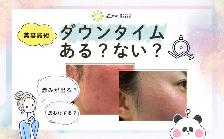 気になる美容施術のダウンタイムある？ない？