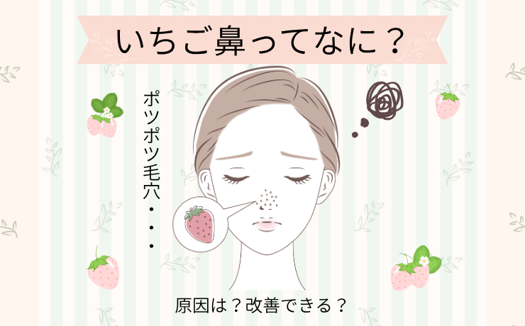 いちご鼻ってなに？🍓